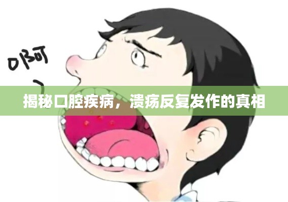 揭秘口腔疾病,溃疡反复发作的真相